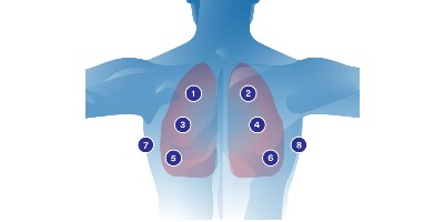 Diagramma sull'auscultazione polmonare
